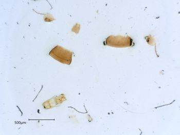 Media type: image;   Entomology 36152 Aspect: genitalia